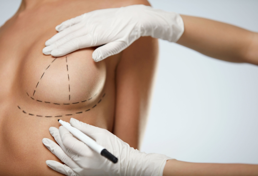 procedimiento-reconstruccion-mamaria